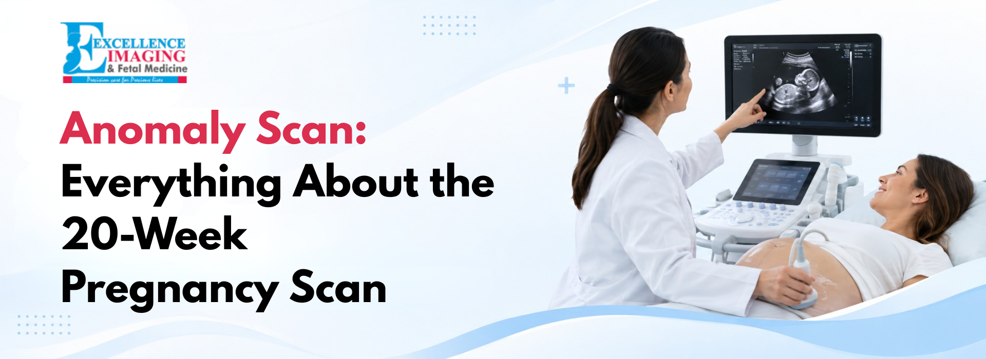 Medical blog banner about the anomaly scan, featuring a pregnant woman undergoing a 20 week ultrasound with the heading 'Anomaly Scan: Everything About the 20-Week Pregnancy Scan' on a clean blue-and-white healthcare background with the Excellence Imaging & Fetal Medicine logo