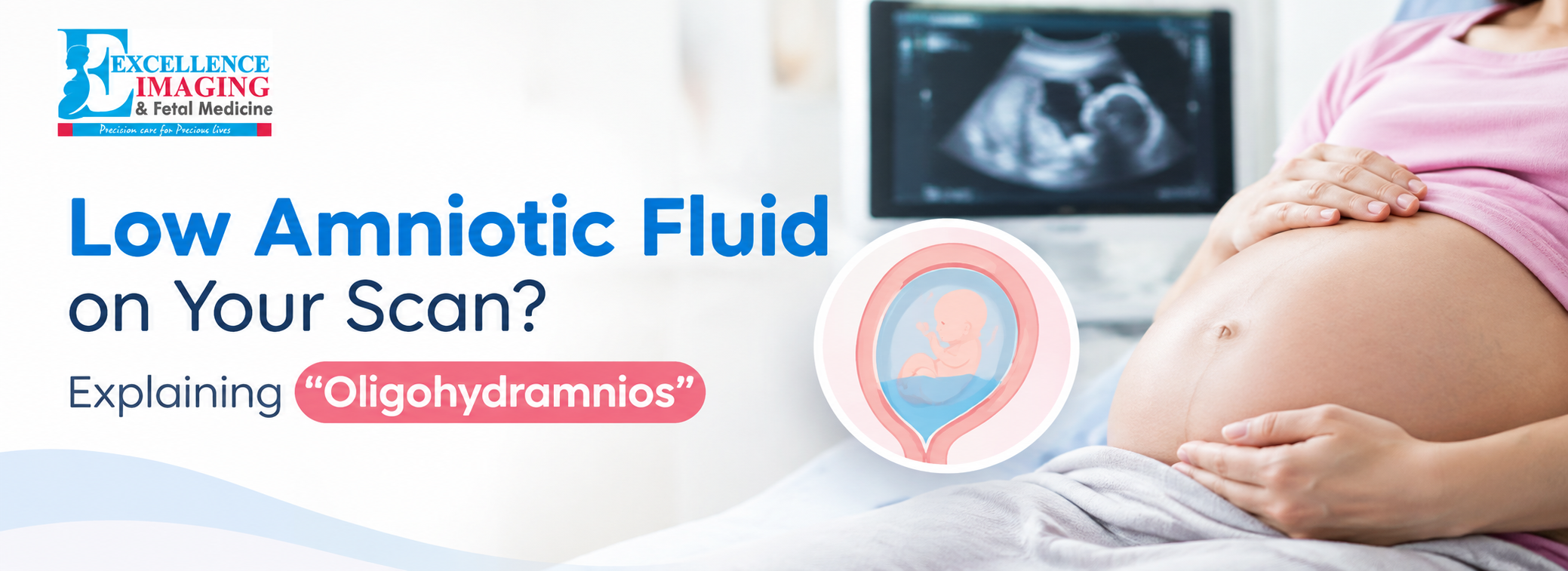 Obstetric ultrasound showing amniotic fluid measurement to check for low amniotic fluid (oligohydramnios) during pregnancy.